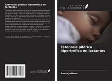 Portada del libro de Estenosis pilórica hipertrófica en lactantes