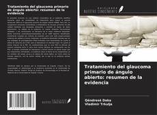 Couverture de Tratamiento del glaucoma primario de ángulo abierto: resumen de la evidencia