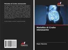 Bookcover of Malattia di Crohn stenosante