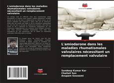 Couverture de L'amiodarone dans les maladies rhumatismales valvulaires nécessitant un remplacement valvulaire
