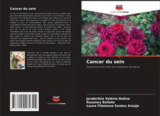Cancer du sein的封面
