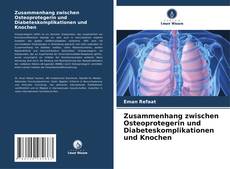 Bookcover of Zusammenhang zwischen Osteoprotegerin und Diabeteskomplikationen und Knochen