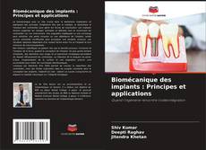 Borítókép a  Biomécanique des implants : Principes et applications - hoz