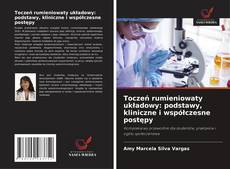 Capa do livro de Toczeń rumieniowaty układowy: podstawy, kliniczne i współczesne postępy 