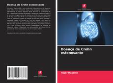 Doença de Crohn estenosante kitap kapağı