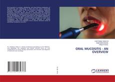 Bookcover of ORAL MUCOSITIS - AN OVERVIEW