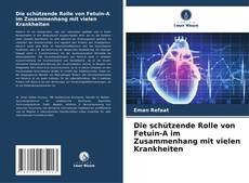Die schützende Rolle von Fetuin-A im Zusammenhang mit vielen Krankheiten的封面