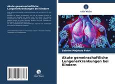 Borítókép a  Akute gemeinschaftliche Lungenerkrankungen bei Kindern - hoz