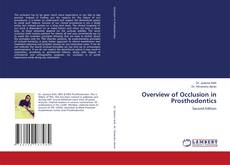 Bookcover of Overview of Occlusion in Prosthodontics
