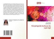Couverture de Pemphigoïde bulleuse du sujet âgé