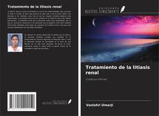 Copertina di Tratamiento de la litiasis renal