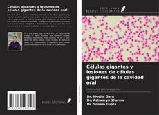 Buchcover von Células gigantes y lesiones de células gigantes de la cavidad oral