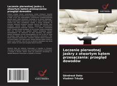 Buchcover von Leczenie pierwotnej jaskry z otwartym kątem przesączania: przegląd dowodów