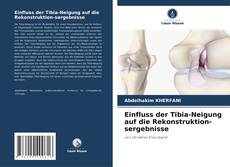 Einfluss der Tibia-Neigung auf die Rekonstruktion-sergebnisse的封面
