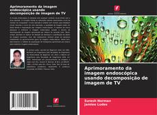 Bookcover of Aprimoramento da imagem endoscópica usando decomposição de imagem de TV