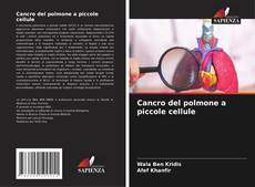 Bookcover of Cancro del polmone a piccole cellule