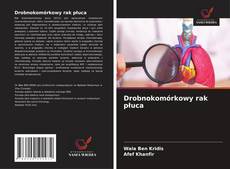 Couverture de Drobnokomórkowy rak płuca