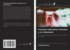Copertina di Fracturas radiculares verticales y su tratamiento