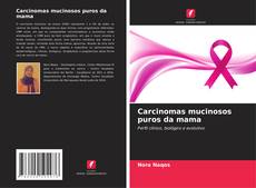 Borítókép a  Carcinomas mucinosos puros da mama - hoz