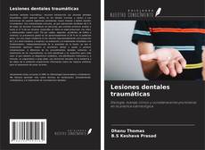 Copertina di Lesiones dentales traumáticas