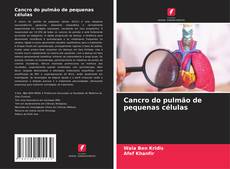 Cancro do pulmão de pequenas células kitap kapağı