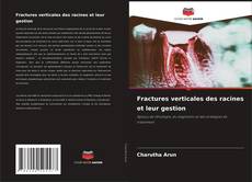 Portada del libro de Fractures verticales des racines et leur gestion