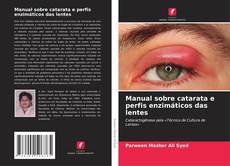 Buchcover von Manual sobre catarata e perfis enzimáticos das lentes