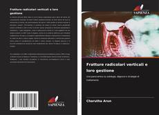 Borítókép a  Fratture radicolari verticali e loro gestione - hoz