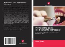 Buchcover von Metformina como medicamento intracanal