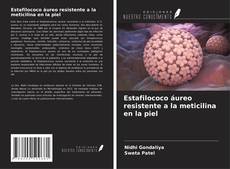 Buchcover von Estafilococo áureo resistente a la meticilina en la piel