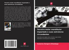 Portada del libro de Terceiro molar mandibular impactado e suas estruturas circundantes