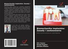 Borítókép a  Biomechanika implantów: Zasady i zastosowania - hoz