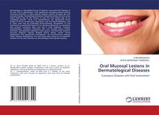 Bookcover of Oral Mucosal Lesions in Dermatological Diseases