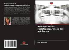 Bookcover of Radiopacités et radiotransparences des mâchoires