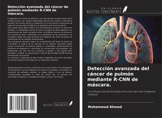 Copertina di Detección avanzada del cáncer de pulmón mediante R-CNN de máscara.