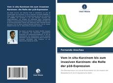 Bookcover of Vom in situ-Karzinom bis zum invasiven Karzinom: die Rolle der p16-Expression