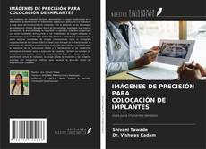 Buchcover von IMÁGENES DE PRECISIÓN PARA COLOCACIÓN DE IMPLANTES