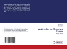 Buchcover von An Overview on Alzheimer's Disease
