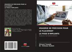 Capa do livro de IMAGERIE DE PRÉCISION POUR LE PLACEMENT LA POSE D'IMPLANTS 