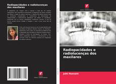 Copertina di Radiopacidades e radiolucenças dos maxilares