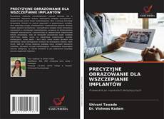 Buchcover von PRECYZYJNE OBRAZOWANIE DLA WSZCZEPIANIE IMPLANTÓW