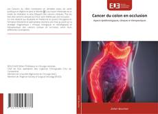Copertina di Cancer du colon en occlusion