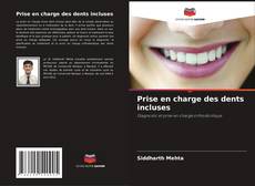 Couverture de Prise en charge des dents incluses