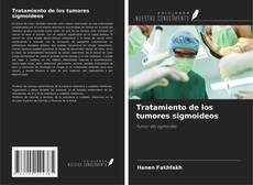 Copertina di Tratamiento de los tumores sigmoideos