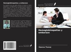 Copertina di Hemoglobinopatías y embarazo