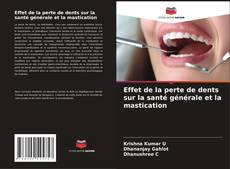 Copertina di Effet de la perte de dents sur la santé générale et la mastication