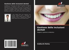 Bookcover of Gestione delle inclusioni dentali