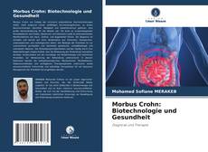 Bookcover of Morbus Crohn: Biotechnologie und Gesundheit