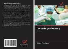 Leczenie guzów esicy kitap kapağı