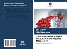 Couverture de Tiefe Venenthrombosen im Zusammenhang mit Neoplasien